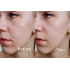 Aphrona LED facial mask, the ideal mask for your face