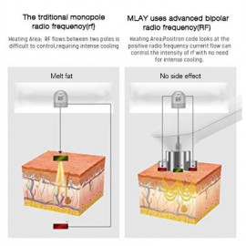 RF Skin Tightening Device – Anti-Aging, Wrinkle Reduction,Face Lifting