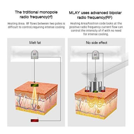 MLAY RF, the device that tightens the skin