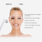 MLAY RF Skin Tightening Device: Professional Anti-Aging for Face & Body - Wrinkle Reduction & Lifting at Home