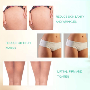 MLAY RF, the device that tightens the skin