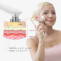 MLAY RF Skin Tightening Device: Professional Anti-Aging for Face & Body - Wrinkle Reduction & Lifting at Home