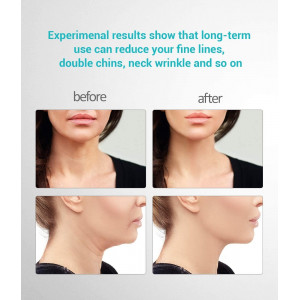 Ms.Ｗ Face Massager, the anti-wrinkle device