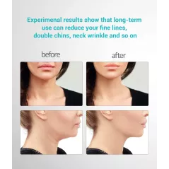 Ms.Ｗ Face Massager, the anti-wrinkle device