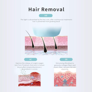 DEESS GP590, une épilation indolore