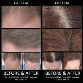 BIOEQUA Traitement de Repousse et Revitalisation des Cheveux