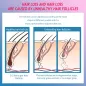 Système CNV Anti-Chute: Revitalisez vos Cheveux avec la Thérapie LED!