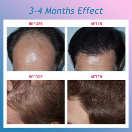 CNV Hair Growth - Restore Your Confidence