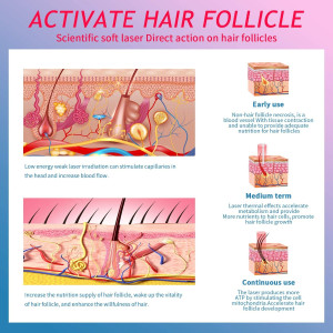 CNV, le casque de repousse pour cheveux