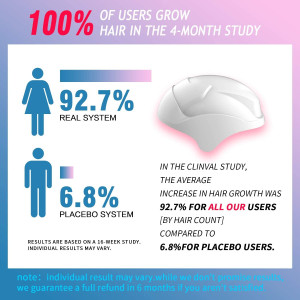 CNV, the hair regrowth helmet