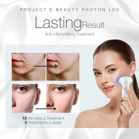 Project E Beauty: Clear Skin LED Therapy - Acne Treatment at Home