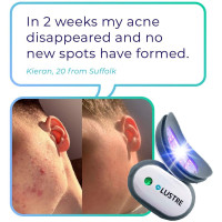 Lustre ClearSkin Solo: Blue Light Acne Treatment - Clearer Skin in Weeks!