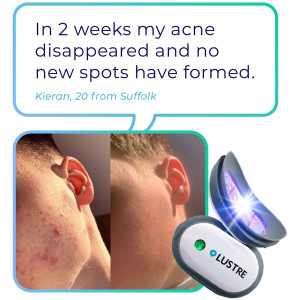 LUSTRE Solo, the acne treatment device