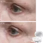 Trophy Skin UltradermMD: At-Home Microdermabrasion for Radiant, Youthful Skin