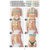 TESMED te780 Plus, EMS and TENS treatment