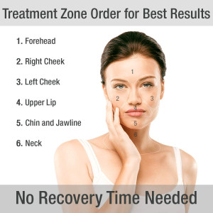 Silk'n Titan, un meilleur raffermissement de la peau