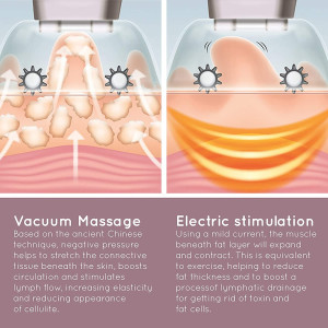 HoMedics CELL-500, le dispositif de succion anti cellulite