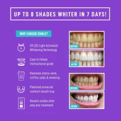 iSmile : Kit de Blanchiment Dentaire LED - Sourire Éclatant et Rapide, Résultats Professionnels à Domicile !