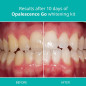 Opalescence Go 10 Mint: Whiten Your Smile Effortlessly! Prefilled Teeth Whitening Trays