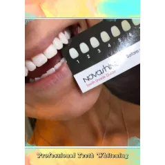 Novashine : Kit de Blanchiment Dentaire LED - Sourire Éclatant Garanti en 15 Minutes!