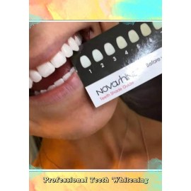 Unlock Your Brightest Smile with Novashine – Naturally White Teeth