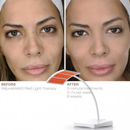 Trophy Skin RejuvaliteMD, the lamp that treats skin