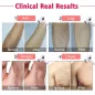 Imene T4: Épilateur à Lumière Pulsée (IPL) - Épilation Définitive, Douce et Efficace à Domicile!