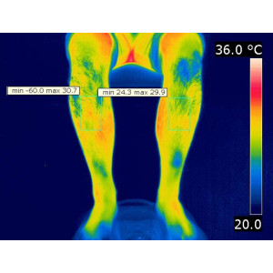Circulation Maxx, le stimulateur circulatoire EMS