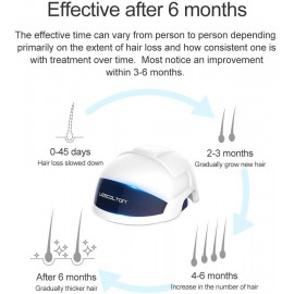 LESCOLTON Laser Hair Growth Device – FDA-Approved Hair Regrowth