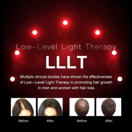 LESCOLTON Laser Hair Growth Device – FDA-Approved Hair Regrowth