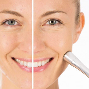 Beurer Professional at-Home Microdermabrasion, Revitalizes, Exfoliates and Rejuvenates Skin - Advanced Facial Treatment