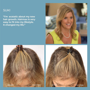 HairMax Laser Hair Growth Comb, FDA Cleared, Ultima 12, Laser Hair Growth Treatment for Men & Women, Thinning Hair Treatment for