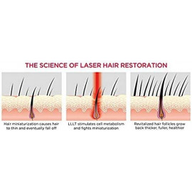 FDA Cleared iRestore Laser Hair Growth System - New Technology