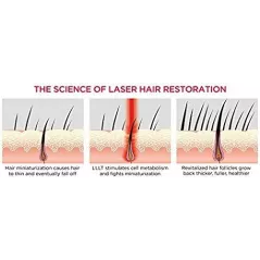 iRestore Essential Laser Hair Growth System | FDA Cleared Hair Regrowth Laser Cap - Red Light Therapy Hair Growth, Hair Loss