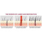 iRestore : Système Laser Anti-Chute de Cheveux Approuvé FDA - Repousse Efficace pour Hommes et Femmes