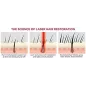 iRestore : Système Laser Anti-Chute de Cheveux Approuvé FDA - Repousse Efficace pour Hommes et Femmes
