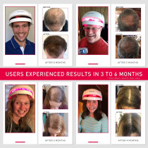 iRestore Essential Laser Hair Growth System | FDA Cleared Hair Regrowth Laser Cap - Red Light Therapy Hair Growth, Hair Loss