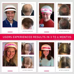 iRestore Essential Laser Hair Growth System | FDA Cleared Hair Regrowth Laser Cap - Red Light Therapy Hair Growth, Hair Loss