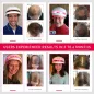 iRestore : Système Laser Anti-Chute de Cheveux Approuvé FDA - Repousse Efficace pour Hommes et Femmes