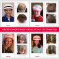 iRestore : Système Laser Anti-Chute de Cheveux Approuvé FDA - Repousse Efficace pour Hommes et Femmes