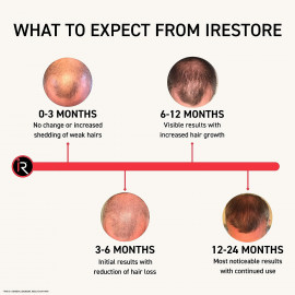 FDA Cleared iRestore Laser Hair Growth System - New Technology