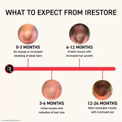 iRestore Essential Laser Hair Growth System | FDA Cleared Hair Regrowth Laser Cap - Red Light Therapy Hair Growth, Hair Loss