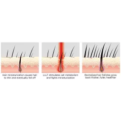 iRestore Essential Laser Hair Growth System | FDA Cleared Hair Regrowth Laser Cap - Red Light Therapy Hair Growth, Hair Loss