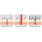 iRestore Laser Hair Growth System: FDA Cleared, Regrow Thicker Hair!