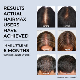 Hairmax RegrowMD - Casquette de croissance des cheveux au laser pou...