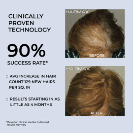 HairMax LaserBand 82 - FDA Cleared, 90 Sec Hair Growth Treatment