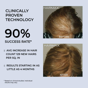 Hairmax Hair Growth Laser Band (FDA Cleared), LaserBand 82 ComfortFlex, Full/Partial Coverage, Hair Growth for Men & Hair