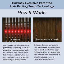 HairMax LaserBand 82 - Approuvé FDA, Traitement Capillaire de 90 Sec