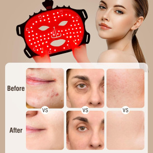 7-Color Red Light Therapy Mask - Anti-Aging, Wrinkle & Spot Reduction