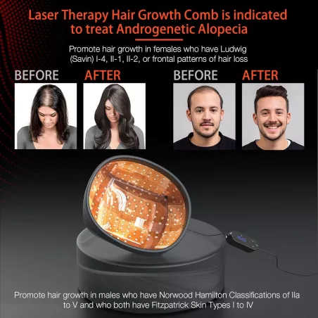 Casque Laser Anti-Chute Révolutionnaire - Repousse des Cheveux Garantie (Approuvé FDA)